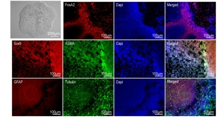 fx: Células Madre + Organoides + Bioprinting 3D / Gene editing + Biomateriales inteligentes = La medicina personalizada del futuro